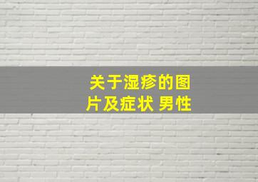 关于湿疹的图片及症状 男性